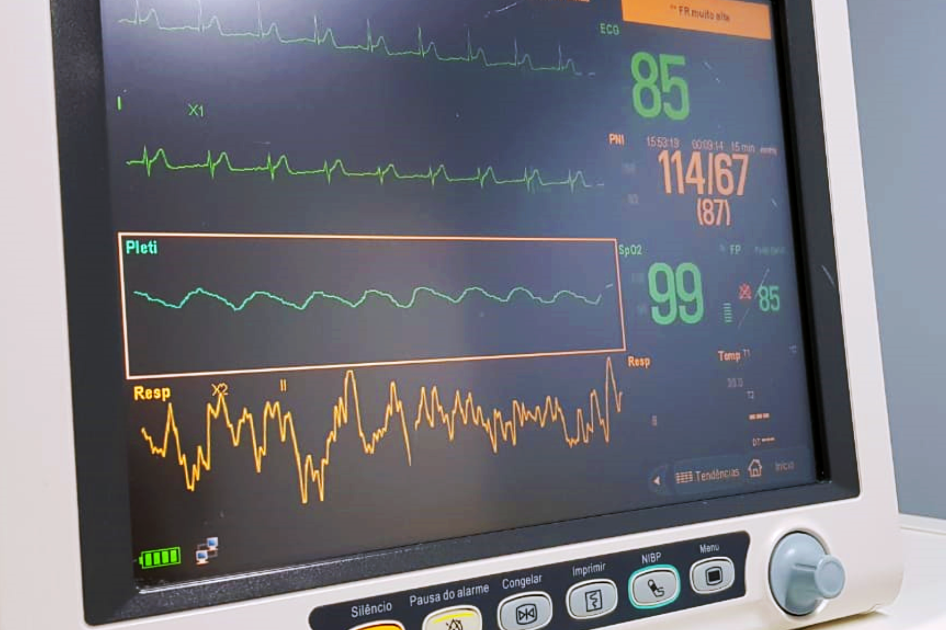 Monitorização Integrada - Hospital Nossa Senhora da Graça